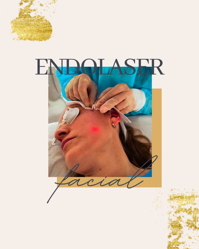 Endolifting 