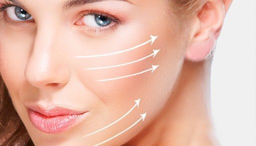 Hilos tensores Madrid, Tratamiento con Hilos, Est&eacute;tica Hilos facial